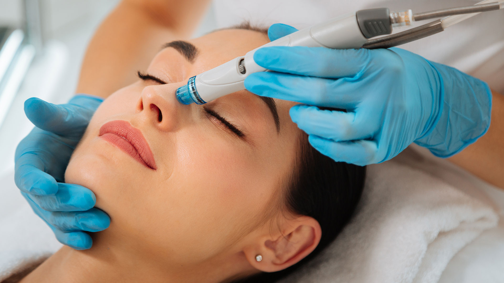 Tratamento de melasma